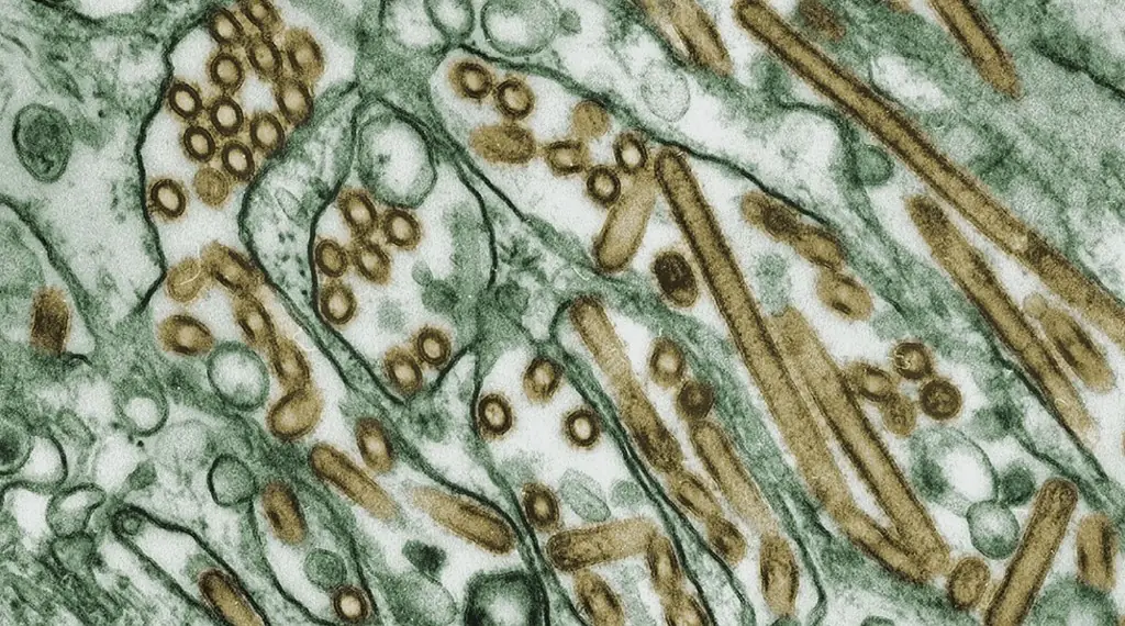 Electron micrograph of avian influenza virus particles